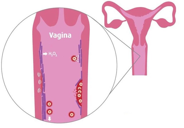 Bào tử lợi khuẩn LiveSpo X - Secret giải pháp mới bảo vệ sức khỏe sinh sản phụ nữ - 2 Bào tử lợi khuẩn LiveSpo X - Secret giải pháp mới bảo vệ sức khỏe sinh sản phụ nữ - 2