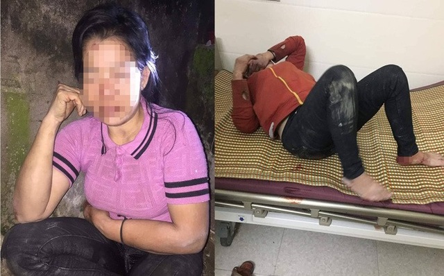 Đã làm rõ được người lạ đánh đập tàn nhẫn người phụ nữ trong đêm - 2 Đã làm rõ được người lạ đánh đập tàn nhẫn người phụ nữ trong đêm - 2
