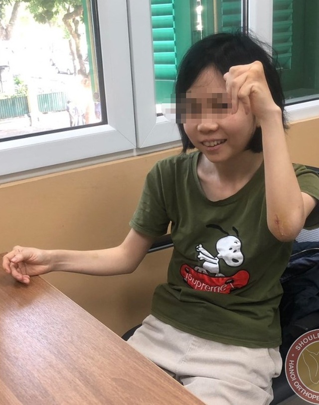 Người phụ nữ 38 tuổi bất lực 10 năm không thể tự chải tóc vì khớp xương biến dạng - 3 Người phụ nữ 38 tuổi bất lực 10 năm không thể tự chải tóc vì khớp xương biến dạng - 3