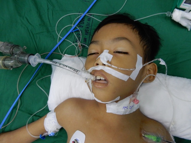 Bác sĩ kêu gọi mạnh thường quân chung tay cứu cậu bé 8 tuổi tính mạng đang nguy kịch - 3 Bác sĩ kêu gọi mạnh thường quân chung tay cứu cậu bé 8 tuổi tính mạng đang nguy kịch - 3