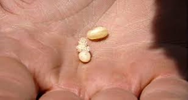 Mỏ vàng dưới rễ cây, lấy về bán hơn 2 triệu đồng/kg thành món... ngon quên sầu - 3 Mỏ vàng dưới rễ cây, lấy về bán hơn 2 triệu đồng/kg thành món... ngon quên sầu - 3