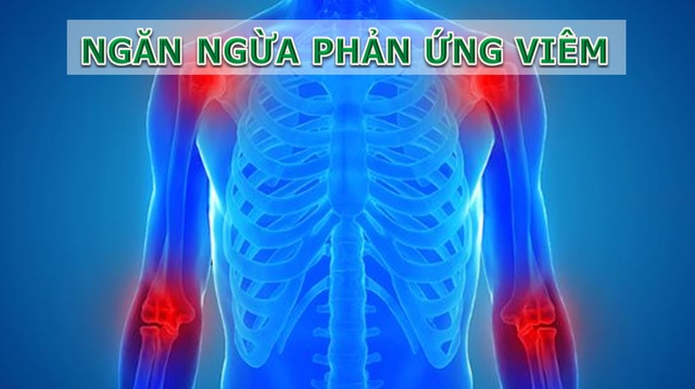 Giải pháp phòng, chống ung thư từ gốc hoàn toàn tự nhiên - 1 Giải pháp phòng, chống ung thư từ gốc hoàn toàn tự nhiên - 1