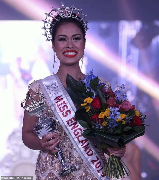 Nữ bác sĩ đi thi Miss World giải cứu cho đối thủ bị gãy xương cổ tay - Ảnh minh hoạ 7