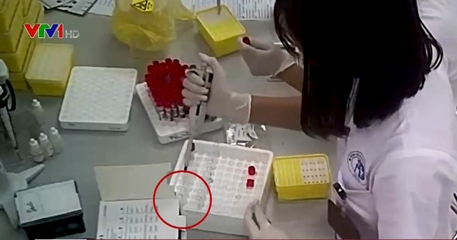 Hàng nghìn que thử HIV, viêm gan B bị cắt đôi trước khi tiến hành xét nghiệm - 5 Hàng nghìn que thử HIV, viêm gan B bị cắt đôi trước khi tiến hành xét nghiệm - 5