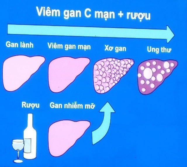 Ung thư gan đang hủy diệt sự sống của người Việt Nam - 3