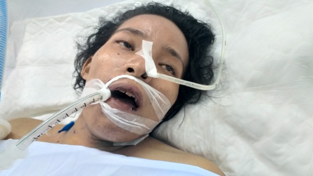 Xót xa hoàn cảnh người phụ nữ buôn ve chai bị hai em học sinh tông xe toàn thân như dập nát - 2 Xót xa hoàn cảnh người phụ nữ buôn ve chai bị hai em học sinh tông xe toàn thân như dập nát - 2