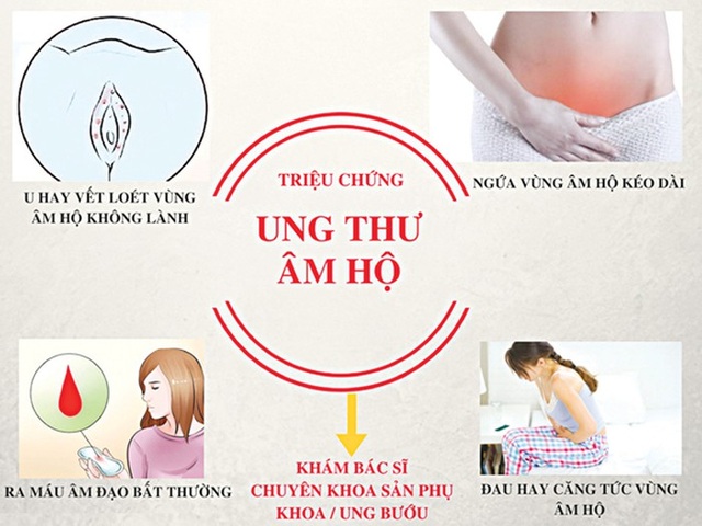 6 dấu hiệu cảnh báo bệnh ung thư âm hộ - 1 6 dấu hiệu cảnh báo bệnh ung thư âm hộ - 1