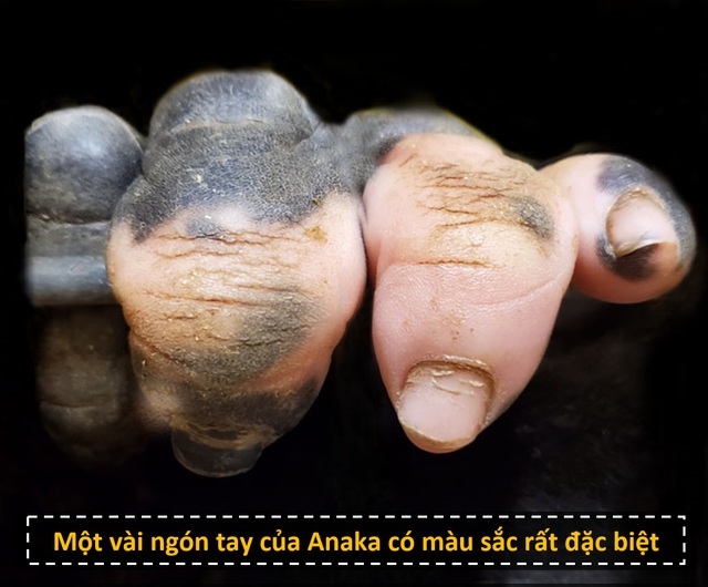 Chú gorilla trở thành ngôi sao mạng xã hội nhờ sở hữu “ngón tay người” - 2 Chú gorilla trở thành ngôi sao mạng xã hội nhờ sở hữu “ngón tay người” - 2