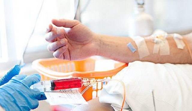 Cách giảm rụng tóc trong thời gian hóa trị ung thư - 1 Cách giảm rụng tóc trong thời gian hóa trị ung thư - 1