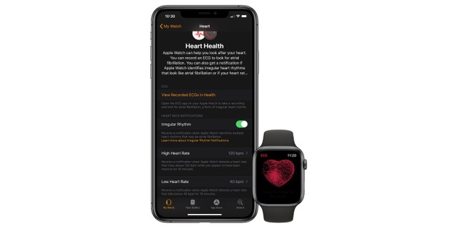 Apple Watch có thể mất tính năng phát hiện nhịp tim do kiện bản quyền? - 2