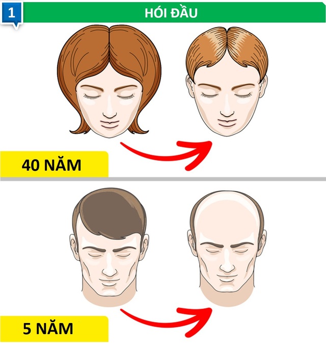 “Kỳ lạ” những vấn đề sức khỏe ảnh hưởng đàn ông và phụ nữ theo cách khác biệt - 1 “Kỳ lạ” những vấn đề sức khỏe ảnh hưởng đàn ông và phụ nữ theo cách khác biệt - 1