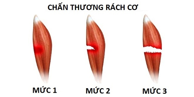 Giám đốc BV Thể thao Việt Nam chỉ ra những rủi ro khi chơi bóng đá phong trào - 3 Giám đốc BV Thể thao Việt Nam chỉ ra những rủi ro khi chơi bóng đá phong trào - 3