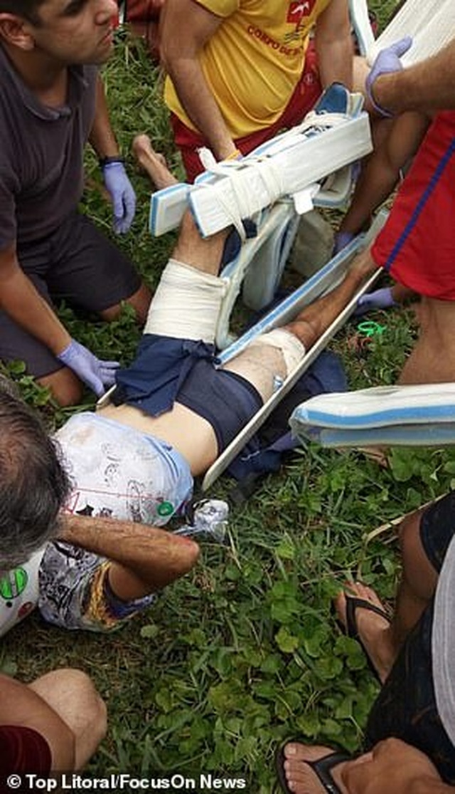Brazil: Sống sót thần kỳ sau khi rơi tự do từ dù lượn - 3 Brazil: Sống sót thần kỳ sau khi rơi tự do từ dù lượn - 3