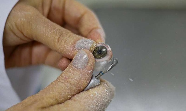 Hành trình kỳ diệu khôi phục một nửa khuôn mặt cho bệnh nhân ung thư - 3 Hành trình kỳ diệu khôi phục một nửa khuôn mặt cho bệnh nhân ung thư - 3