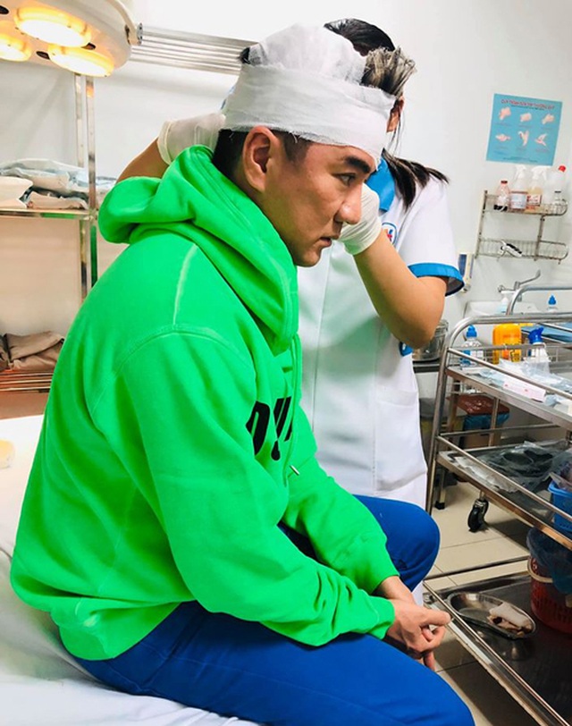 Đàm Vĩnh Hưng bị chảy máu đầu khi đang hát trên sân khấu - 1 Đàm Vĩnh Hưng bị chảy máu đầu khi đang hát trên sân khấu - 1