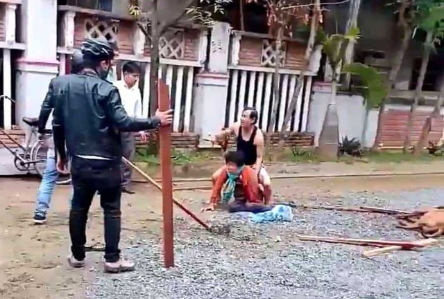 Chó cưng tấn công người - những câu chuyện kinh hãi sởn da gà! - 1 Chó cưng tấn công người - những câu chuyện kinh hãi sởn da gà! - 1