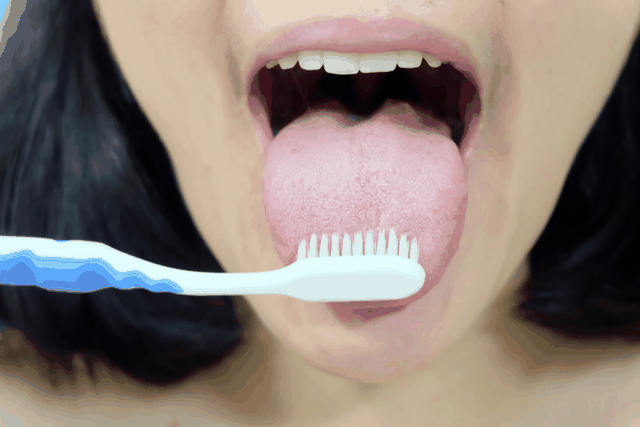 Ung thư lưỡi ngày càng phổ biến, bác sĩ cảnh báo 4 nguyên nhân gây bệnh - 3 Ung thư lưỡi ngày càng phổ biến, bác sĩ cảnh báo 4 nguyên nhân gây bệnh - 3