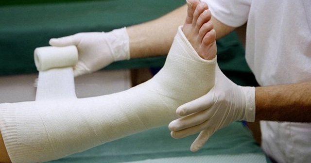 Tuyệt đối lưu ý nếu không may bị gãy xương, bỏng trong dịp năm mới - 1 Tuyệt đối lưu ý nếu không may bị gãy xương, bỏng trong dịp năm mới - 1