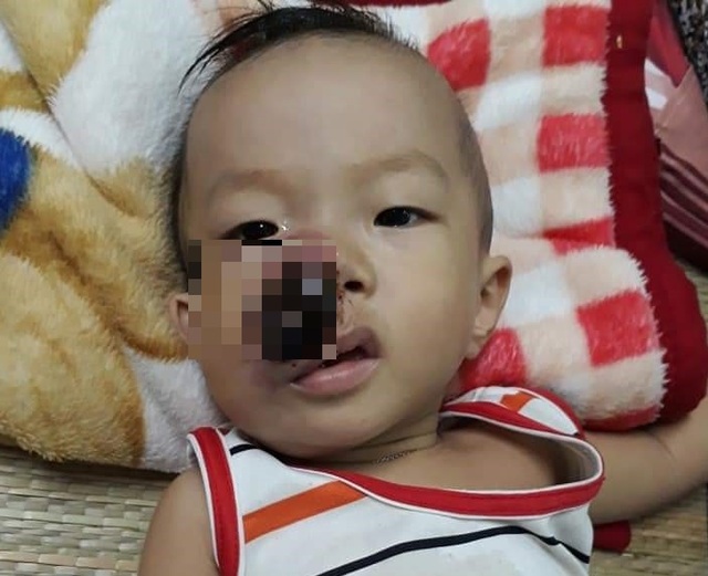 Bé 3 tuổi khóc lạc giọng gọi: Mẹ ơi! mẹ cứu con - 1 Bé 3 tuổi khóc lạc giọng gọi: Mẹ ơi! mẹ cứu con - 1