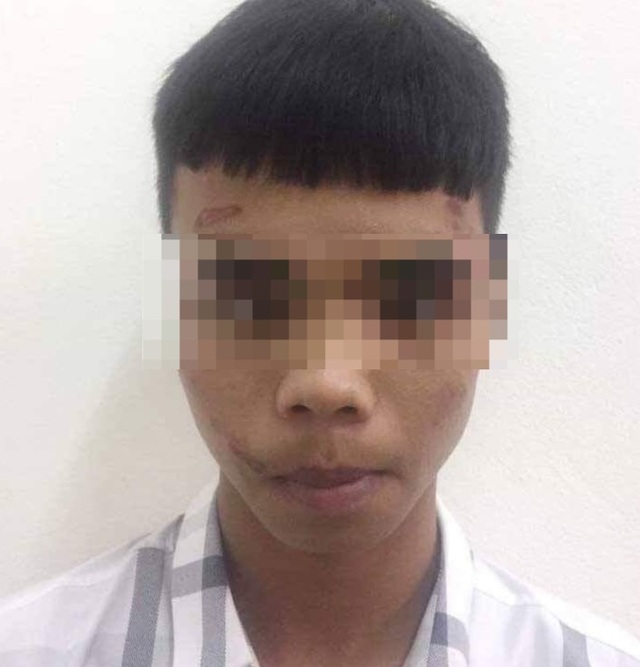 Bị doạ cướp, cô gái bình tĩnh làm đối tượng bất tỉnh - 1 Bị doạ cướp, cô gái bình tĩnh làm đối tượng bất tỉnh - 1