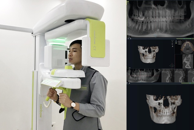 Nha khoa Lạc Việt Intech – Trung tâm trồng răng implant công nghệ cao - 2 Nha khoa Lạc Việt Intech – Trung tâm trồng răng implant công nghệ cao - 2