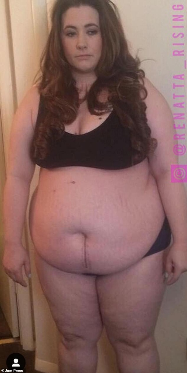 Cô gái 131 kg giảm cân ngoạn mục thành 