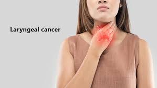 5 dấu hiệu không ngờ cảnh báo ung thư thanh quản - 1 5 dấu hiệu không ngờ cảnh báo ung thư thanh quản - 1