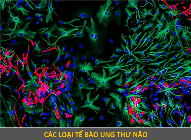 Vẻ ma mị của những tế bào ung thư đạt giải trong cuộc thi nhiếp ảnh - 1 Vẻ ma mị của những tế bào ung thư đạt giải trong cuộc thi nhiếp ảnh - 1