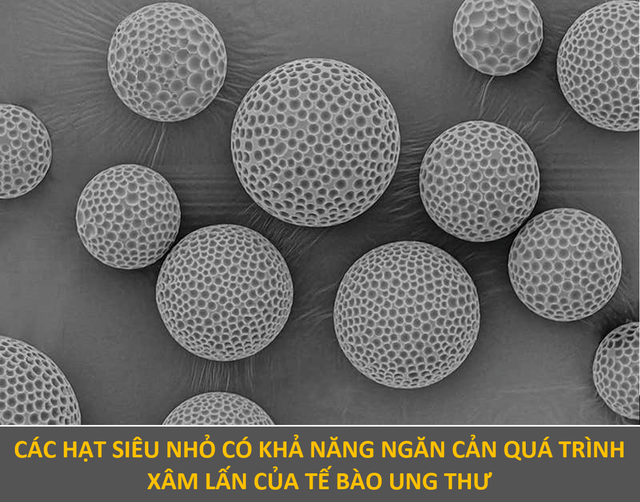 Vẻ ma mị của những tế bào ung thư đạt giải trong cuộc thi nhiếp ảnh - 2 Vẻ ma mị của những tế bào ung thư đạt giải trong cuộc thi nhiếp ảnh - 2