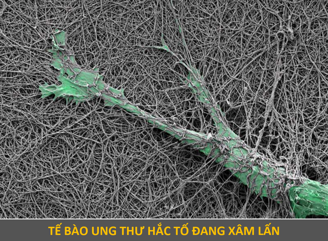 Vẻ ma mị của những tế bào ung thư đạt giải trong cuộc thi nhiếp ảnh - 3 Vẻ ma mị của những tế bào ung thư đạt giải trong cuộc thi nhiếp ảnh - 3