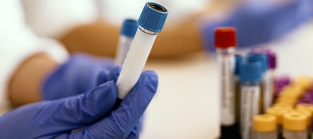 Công ty Mỹ hoàn thành lô vắc-xin thử nghiệm đầu tiên chống virus corona