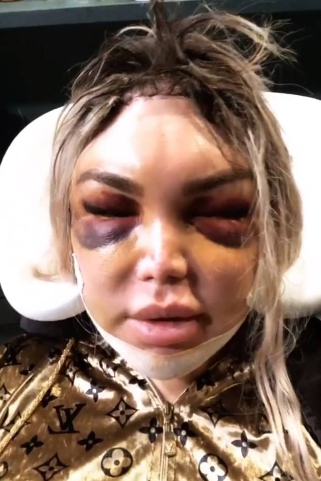 Roddy Alves điệu đà ra phố sau khi chuyển giới - 6