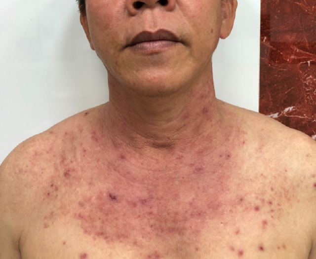 Tắm nắng mùa xuân coi chừng hủy hoại làn da - 1 Tắm nắng mùa xuân coi chừng hủy hoại làn da - 1