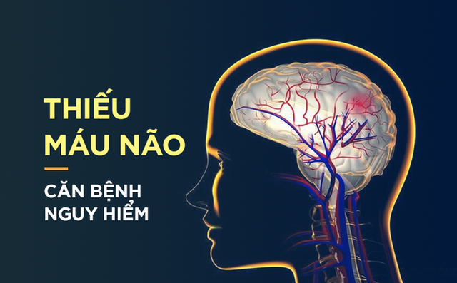 Giải pháp nào tốt cho người thiếu máu lên não? - 1