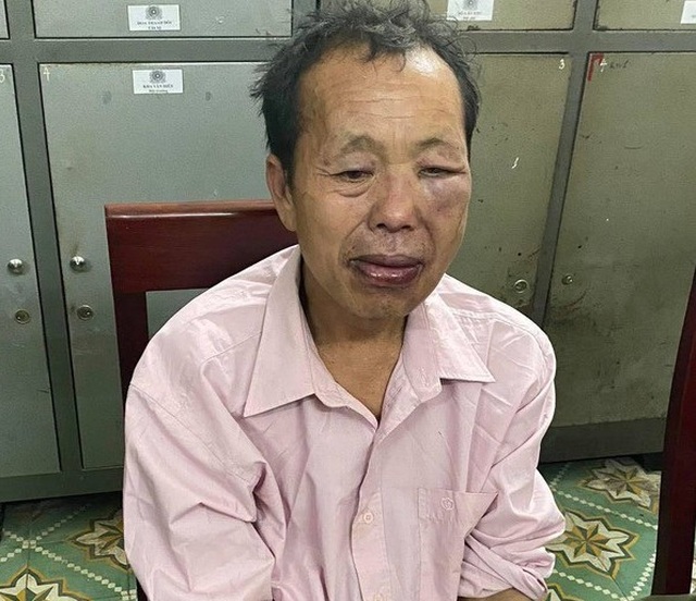 Truy bắt tội phạm ma túy, 1 chiến sĩ công an bị đâm chết - 1 Truy bắt tội phạm ma túy, 1 chiến sĩ công an bị đâm chết - 1