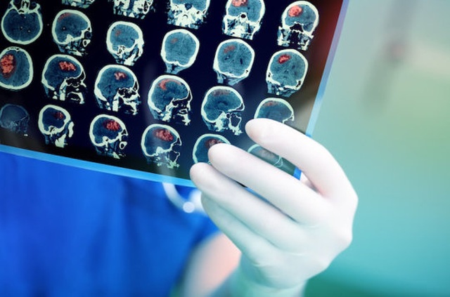 Biến virus chết người trở thành đồng minh trong cuộc chiến chống ung thư - 1 Biến virus chết người trở thành đồng minh trong cuộc chiến chống ung thư - 1