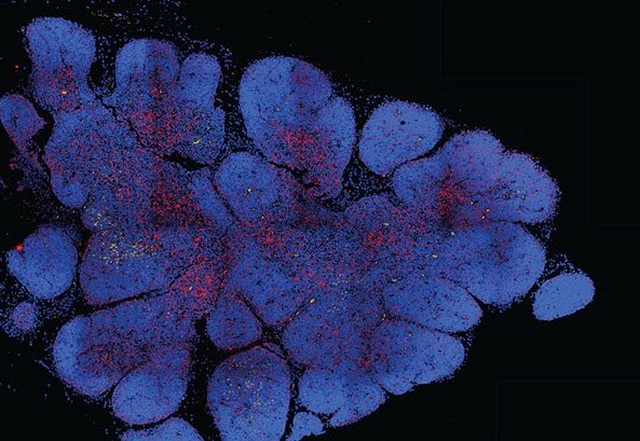 Bản đồ tế bào tuyến ức mở ra phương pháp điều trị ung thư hoàn toàn mới - 2