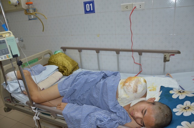 Thương chàng trai lớp 11 mồ côi cha bị điện cao thế phóng người bốc khói - 4 Thương chàng trai lớp 11 mồ côi cha bị điện cao thế phóng người bốc khói - 4