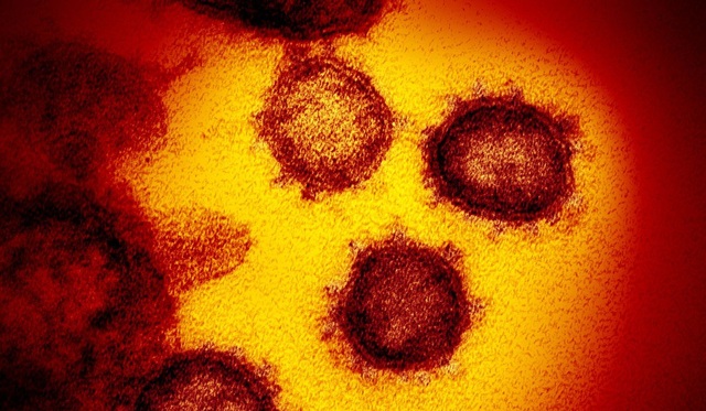 Nghiên cứu: Virus corona có thể đã lây ở người hàng chục năm - 2