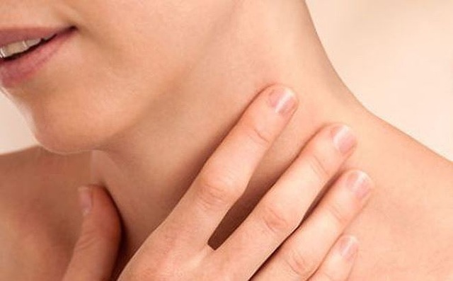 Nổi hạch ở cổ có phải do ung thư? - 1 Nổi hạch ở cổ có phải do ung thư? - 1