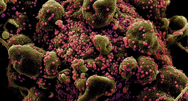 Các nhà khoa học Nga nói về những hậu quả nguy hiểm khi nhiễm coronavirus - 1 Các nhà khoa học Nga nói về những hậu quả nguy hiểm khi nhiễm coronavirus - 1