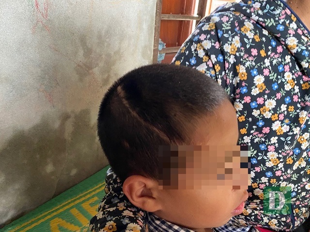 Hệ lụy khôn lường và những khó khăn trong quản lý các đối tượng ngáo đá - 2