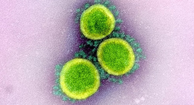 Tìm ra điểm yếu trong lớp màng của coronavirus - 1