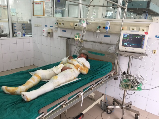 Ba người trong gia đình bị lửa thiêu nguy kịch cầu mong nhà hảo tâm giúp đỡ - 4