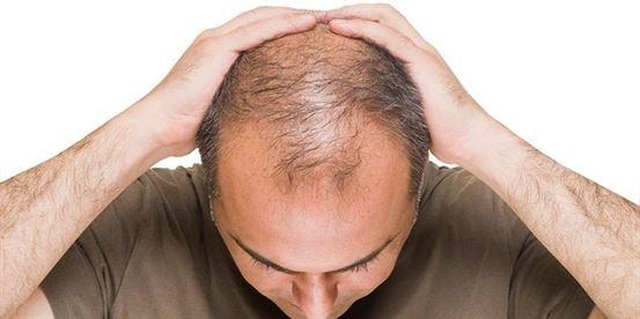 Viên sủi mọc tóc, hạn chế tóc bạc Long Hair - Bí quyết làm đẹp cho mái tóc của bạn - 1 Viên sủi mọc tóc, hạn chế tóc bạc Long Hair - Bí quyết làm đẹp cho mái tóc của bạn - 1