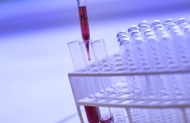 Roche phát triển xét nghiệm huyết thanh học mới nhằm phát hiện các kháng thể Covid-19 - 1 Roche phát triển xét nghiệm huyết thanh học mới nhằm phát hiện các kháng thể Covid-19 - 1