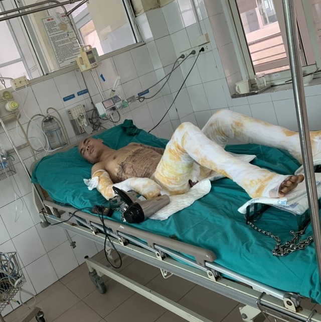 Bạn đọc báo Dân trí giúp đỡ gia đình 3 người bị bỏng hơn 500 triệu đồng - 2 Bạn đọc báo Dân trí giúp đỡ gia đình 3 người bị bỏng hơn 500 triệu đồng - 2