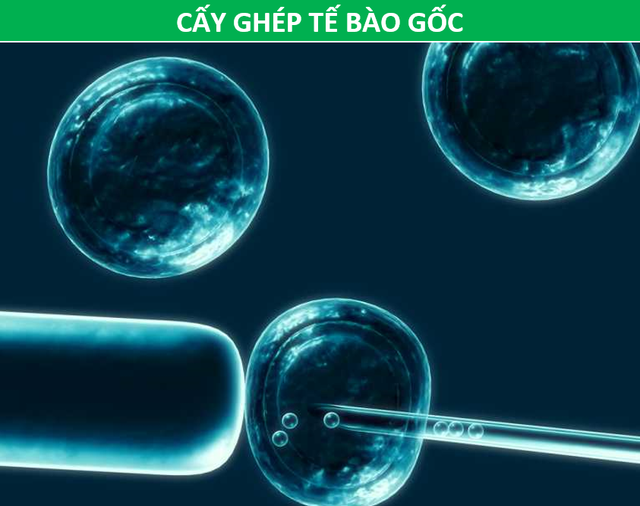 Các phương pháp điều trị ung thư khác nhau như thế nào? - 6 Các phương pháp điều trị ung thư khác nhau như thế nào? - 6