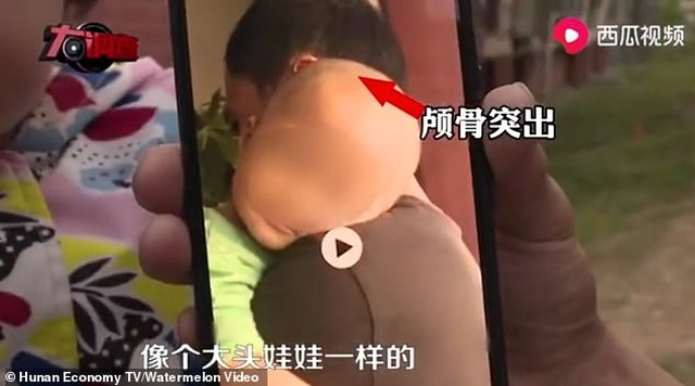 Trung Quốc điều tra nghi vấn sữa giả làm trẻ sơ sinh to đầu - 1 Trung Quốc điều tra nghi vấn sữa giả làm trẻ sơ sinh to đầu - 1
