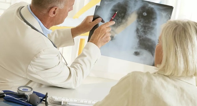 Tìm ra phương pháp cứu chữa phổi của bệnh nhân Covid-19 - 1